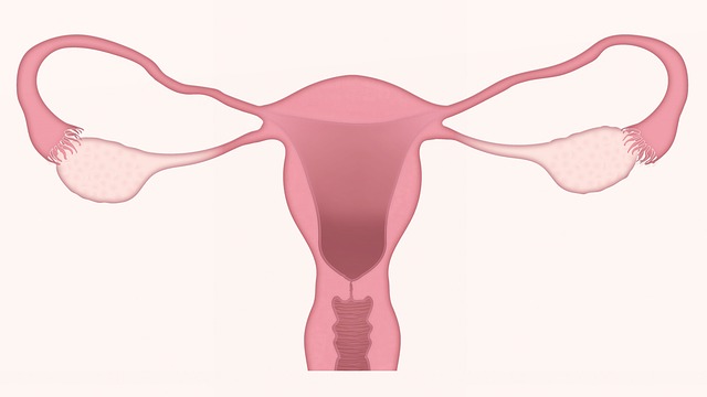 macica endometrioza